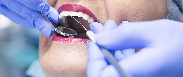 Best Urgent Care for Lost Fillings or Crowns in La Plata, MO